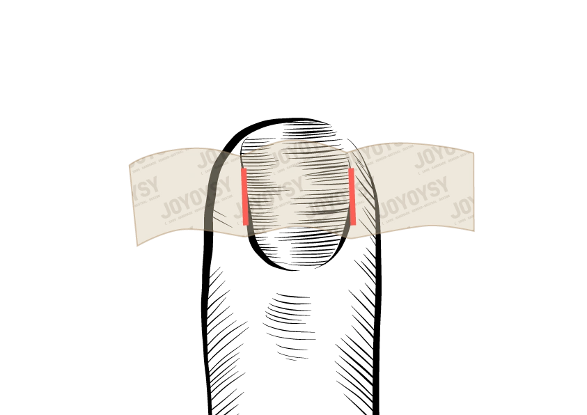 Measuring Your Nails S2 Mark